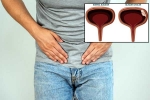 Bladder Cancer prevention, Bladder Cancer experts, why is bladder cancer common in men, E cigarette
