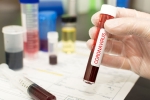 COVID-19, coronavirus, covid 19 vaccine likely by 2021 who, Hydroxychloroquine