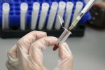 Ebola Virus, Human Antibodies To Fight Ebola, new human antibodies to combat ebola, Sudan virus