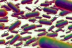 E.coli Outbreak symptoms, E.coli Outbreak, all about e coli outbreak in the united kingdom, Boots