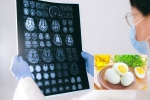 Eggs and Alzheimer’s food, Eggs and Alzheimer’s breakfast, eggs may help prevent alzheimer s study, Eggs