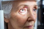 Glaucoma latest breaking, Glaucoma experts, all about the eye disease glaucoma, Glaucoma