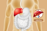 Fatty Liver lifestyle changes, Fatty Liver, dangers of fatty liver, Development