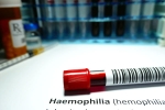 Hemophilia, Hemophilia doctors, why are men likely to develop hemophilia, Brain hemorrhage
