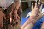 lifestyle, black henna tattoo burns, henna tattoo cause aussie woman to almost lose her hand, Tattoos