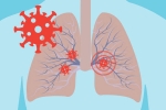 covid toe, covid toe, how does covid 19 affect different parts of the body, Neurology