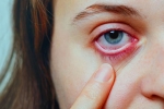 Conjunctivitis cure, Conjunctivitis videos, special measures to prevent conjunctivitis, Conjunctivitis