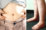 Water Retention human body, Water Retention survey, some effective ways to reduce water retention, Heart diseases