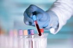 antibodies, AB8, researchers discover an antibody that can cure covid 19 what is it, Human trials