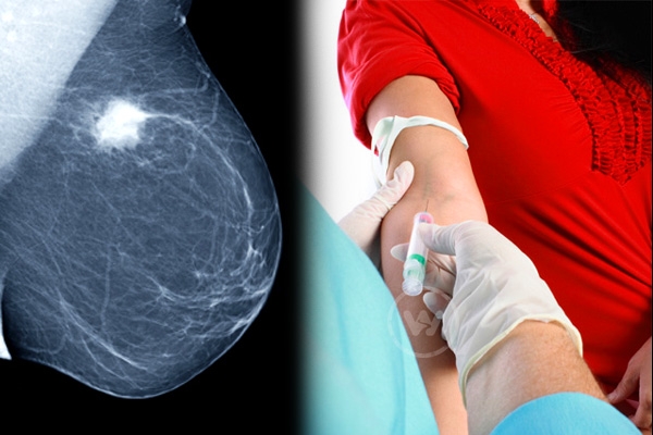 Blood Test to Predict the Risk of Breast Cancer!},{Blood Test to Predict the Risk of Breast Cancer!