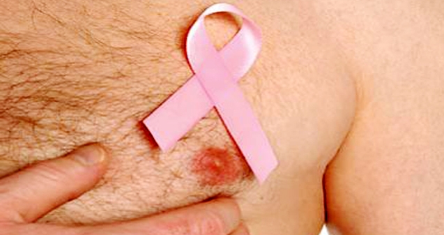 Men get breast cancer too},{Men get breast cancer too